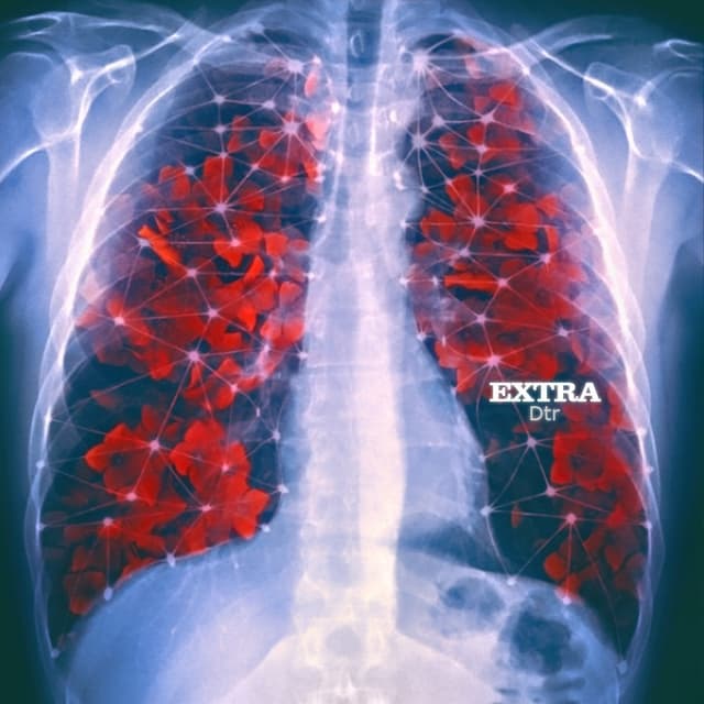 Extra · Alireza DTR